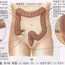 커피를 이용한 대장세척의 효과 이미지