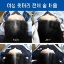 나는 소년이었다 SMP 이미지