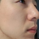 미백·주름을 동시에 잡아줘서 남자피부에도 딱 맞는 더와이 앰플 리얼 후기