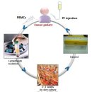 [간암 항암면역세포치료] 이뮨셀 [Gastroenterology] Adjuvant immunotherapy with autologous CIK cells for HCC [동네명의 박춘묵] 이미지