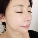 역삼로 | 강남 피부관리 벨라인 에스테틱 LDM 물방울 관리 후기