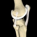 "십자인대"- 무릎을 지지해 주는 십자인대, 십자인대 파열 원인과 치료 이미지