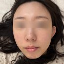 시흥휴먼피부과의원 | [시흥 대야동] 주사피부염 피부과 첫 진료 후기｜홍조, 열감, 트러블 진단부터 처방까지(1편) ⭐