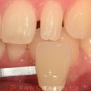 프라임에스치과교정과치과병원 이미지