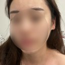 노원피부관리 노원여드름 헤바스킨앤바디 후기
