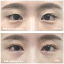 옳은손성형외과