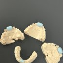 하이교정치과기공소 이미지