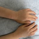 더마렉스코리아 이미지