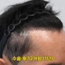 모엠의원 Daum카페