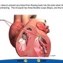 Heart anatomy 이미지