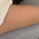 에소코핏 - 고양시 일산서구 주화로 70 | [청주 다이어트] 누워서 할 수 있는 체형 관리 "에소코핏 청주점"후기