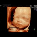 분당-28 | 임신 28주 분당제일여성병원 입체초음파 후기! 얼굴 잘 보여주는 아기☺️