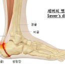 발 뒤꿈치 들기 운동 이미지