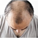 어드반SMP 이미지