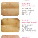 조에피부과 네이버블로그