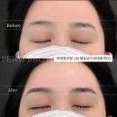 팽브로우 | 홍대 눈썹 찐후기｜팽브로우에서 느꼈던 가장 솔직한 변화