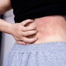 유천신세계정형외과의원 | 아토피, 왜 생기고 어떻게 관리해야 할까요?