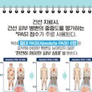 피부 건선 초기 증세 원인 낫는법 이미지