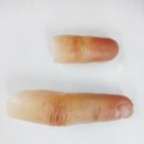 바른의수족제작연구소 이미지