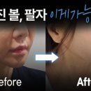 세가지소원성형외과의원 | 팔자주름·입가처짐, 광대부터 정리하는 리프팅? 다움성형외과 김대현 원장님의 걸리버리프트 후기