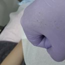 에이오제이 | 노원 마들역피부관리 에이오제이 여드름압출 포어스파라이트 후기