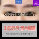 티포인트성형외과의원 네이버블로그