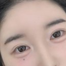 율량동 헤어라인 반영구와 미인점 후기