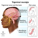 Re: 삼차 신경 전기자극 --＞ 뇌손상 보호, 편두통 치료 탐구!! 이미지
