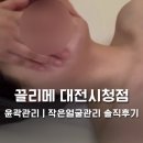 대전광역시청 | 대전피부관리 끌리메 대전시청점, 예비신부관리를 위한 대전윤곽관리 솔직후기!