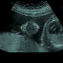 제일미즈여성의원 | [임신 23주차 기록] 정밀초음파 | 소요시간, 비용 등 유성미즈제일여성병원 정밀초음파 검사 후기