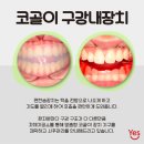 예스치과기공소 이미지