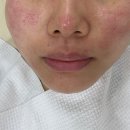 유포리아 에스테틱 이미지