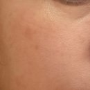 하하세탁소 | “하남피부관리 후기! 올가드림뷰티 하남덕풍점 모낭충 검사까지 해주네요!”