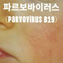 B19-1 이미지