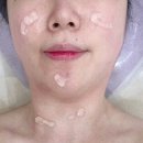 보누스킨