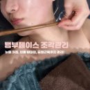 [명동 피부관리] 웨딩관리 추천, 서윤피부맑음 명동점 뱀부페이스 조각관리 후기