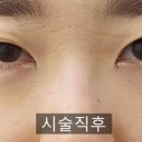 인디언짐 이미지