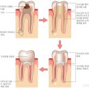 와이플란트치과 네이버블로그
