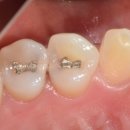 보배로운치과의원 이미지