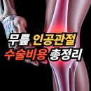 동남공단 | 무릎 인공관절 수술비용 총정리