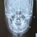 이을치과의원 | 반포치과 이을치과의원 턱관절소리 얼굴비대칭 개선