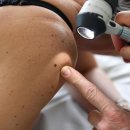 Cancer : la France doit savoir pourquoi elle est surexposée 이미지