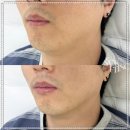 아룸뷰티 이미지