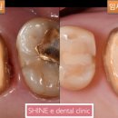 샤인치과기공소 이미지