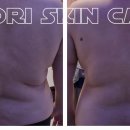 두리스킨케어 이미지