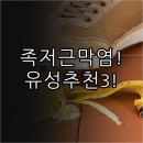 노은정형외과의원 | 대전 유성구 족저근막염 치료 잘하는 곳 | 추천 병원 3곳과 비수술 치료법