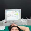 (주)다한디자인 | 안양 성형외과 미라드라이 내돈내산 후기 겨드랑이땀 다한증 액취증 관리