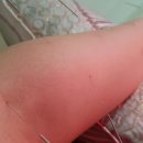 경희김주원한의원 네이버블로그