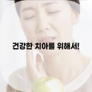 365서울탑플란트치과의원 네이버블로그