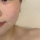 부산임산부관리 연산동산전관리 피로니스킨앤바디 딸고 산전관리 후기